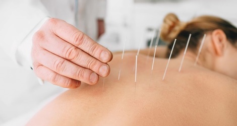 Indigo Acupuncture